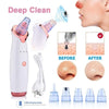 Electric USB Rechargeable Blackhead and Pore Remover